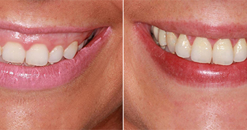 Cosmetic Surgery