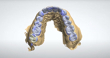 Digital Smile Design