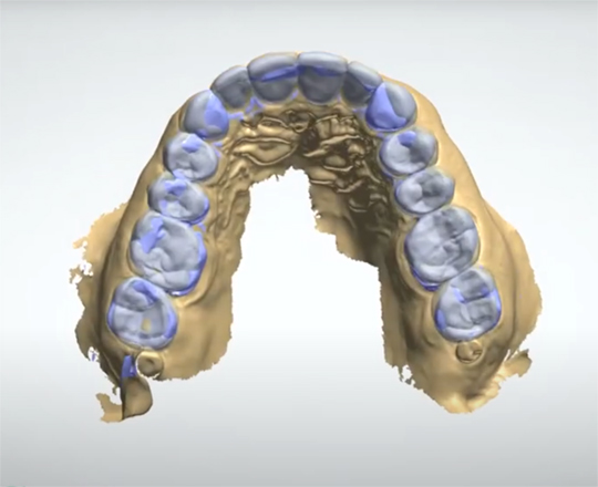 Digital Smile Design